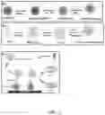 Fig. 03 - NANOPARTICLE-ENHANCED ENZYMATIC IMMUNE BIOSENSOR ASSAY FOR ANTIGEN DETECTION