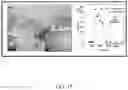 Fig. 16 - NANOPARTICLE-ENHANCED ENZYMATIC IMMUNE BIOSENSOR ASSAY FOR ANTIGEN DETECTION