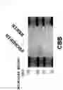Fig. 02 - IMMUNOLOGICAL MEASUREMENT METHOD FOR RENIN CONCENTRATION