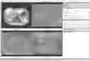 Fig. 01 - Comprehensive cardiovascular analysis with volumetric phase-contrast MRI