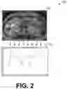 Fig. 03 - Methods and systems for estimating transmit attenuation for a magnetic resonance imaging scan