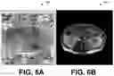 Fig. 06 - Methods and systems for estimating transmit attenuation for a magnetic resonance imaging scan