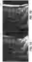 Fig. 07 - Methods and systems for estimating transmit attenuation for a magnetic resonance imaging scan