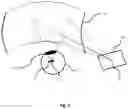 Fig. 03 - Near-to-eye display device using a spatial light modulator