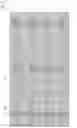 Fig. 03 - LIQUID CRYSTAL DISPLAY DEVICE