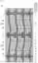 Fig. 07 - LIQUID CRYSTAL DISPLAY DEVICE