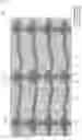 Fig. 12 - LIQUID CRYSTAL DISPLAY DEVICE
