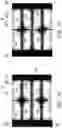Fig. 10 - Pixel structure