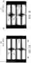 Fig. 15 - Pixel structure