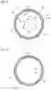 Fig. 03 - Annular rotating bezel system comprising a spring ring provided with at least two lugs