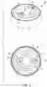 Fig. 04 - Automatic locking knob assemblies and methods of use
