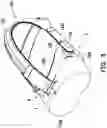 Fig. 12 - Head-mounted display device