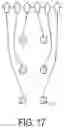 Fig. 18 - Apparatus and methods for enhancing digit separation and reproduction