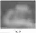 Fig. 35 - Apparatus and methods for enhancing digit separation and reproduction
