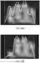 Fig. 46 - Apparatus and methods for enhancing digit separation and reproduction