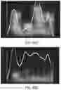 Fig. 47 - Apparatus and methods for enhancing digit separation and reproduction