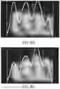 Fig. 48 - Apparatus and methods for enhancing digit separation and reproduction