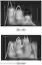 Fig. 49 - Apparatus and methods for enhancing digit separation and reproduction
