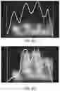 Fig. 50 - Apparatus and methods for enhancing digit separation and reproduction