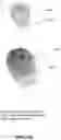 Fig. 18 - Optical sensing of fingerprints or other patterns on or near display screen using optical detectors integrated to display screen