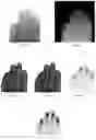 Fig. 04 - Method for processing images of fingerprints