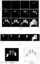 Fig. 05 - Method for processing images of fingerprints