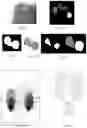 Fig. 06 - Method for processing images of fingerprints