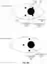 Fig. 06 - Eye tracking using time multiplexing