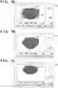 Fig. 08 - Image processing system, processing method, and storage medium