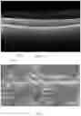 Fig. 05 - Image analysis using machine learning and human computation