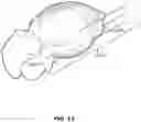Fig. 13 - System and method of mitral valve quantification