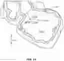 Fig. 15 - System and method of mitral valve quantification