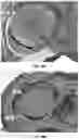 Fig. 20 - System and method of mitral valve quantification