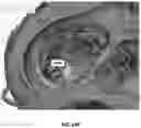 Fig. 21 - System and method of mitral valve quantification