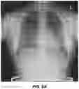 Fig. 10 - Bone suppression for chest radiographs using deep learning