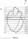 Fig. 04 - Method and apparatus for adjusting a model of an anatomical structure