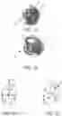 Fig. 02 - Head positioner for retinal surgery patients