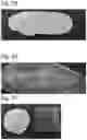 Fig. 13 - Multisensory wound simulation