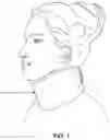 Fig. 02 - NECK SUPPORT WITH RADIATION PROTECTION