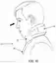 Fig. 09 - NECK SUPPORT WITH RADIATION PROTECTION