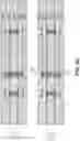 Fig. 15 - High density embedded interconnects in substrate