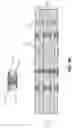 Fig. 17 - High density embedded interconnects in substrate