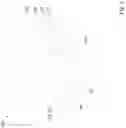 Fig. 03 - V-shape recess profile for embedded source/drain epitaxy