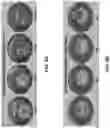 Fig. 06 - LITHIUM SOLID STATE ELECTROLYTE INTERFACE TREATMENT