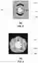 Fig. 03 - Apparatus and methods for launching electromagnetic waves having a certain electric field structure