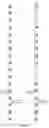 Fig. 04 - Methods and apparatuses for reference signal transmission