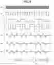 Fig. 07 - Baud rate modulating magnetic stripe data transmitter, system, and method