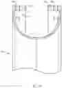 Fig. 05 - Headband assembly