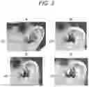 Fig. 04 - Headphone