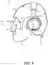 Fig. 09 - Headphones with interactive display